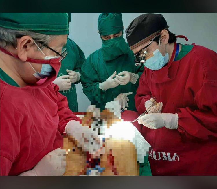 POR PRIMERA VEZ SE REALIZA CIRUGÍA VASCULAR PERIFÉRICA EN EL HOSPITAL REGIONAL DE CORONEL OVIEDO